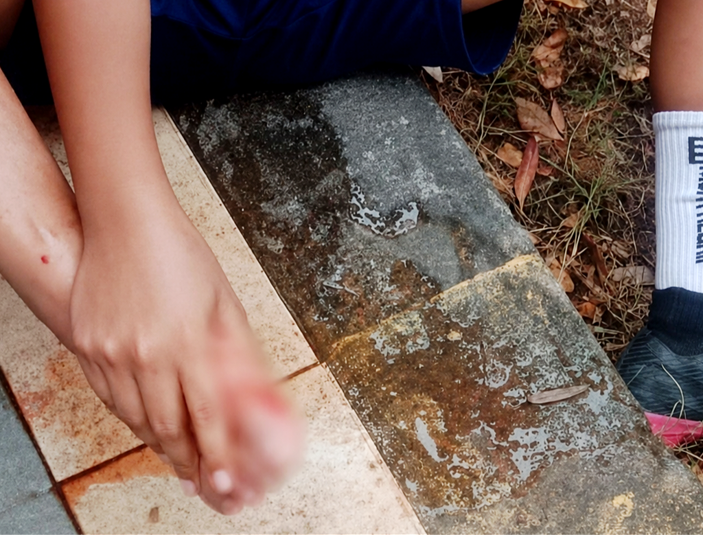 Anak SSB Tertusuk Tusuk Siomay, Warga Desak Pengawasan dan Kebersihan Lapangan Gaspa Anak SSB Tertusuk Tusuk Siomay, Warga Desak Pengawasan dan Kebersihan Lapangan Gaspa