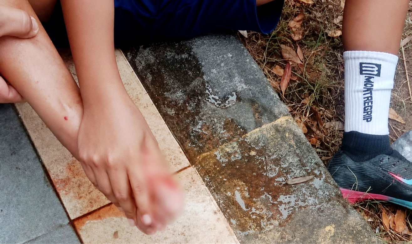 Anak SSB Tertusuk Tusuk Siomay, Warga Desak Pengawasan dan Kebersihan Lapangan Gaspa